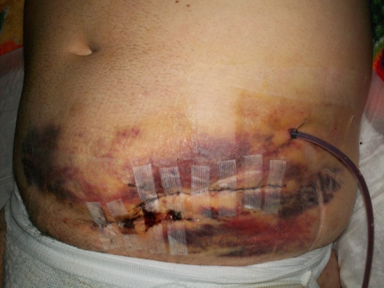 Wound healing initial visit