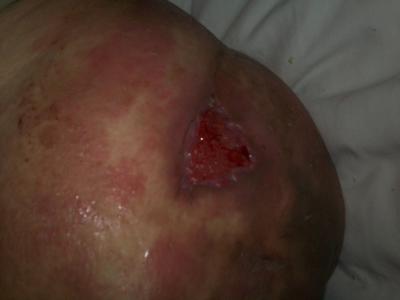 Wound healing initial visit